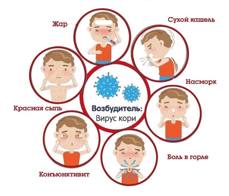 Будьте внимательны к своему здоровью! Лучший способ избежать крайне негативных последствий кори – вовремя пройти  вакцинацию!